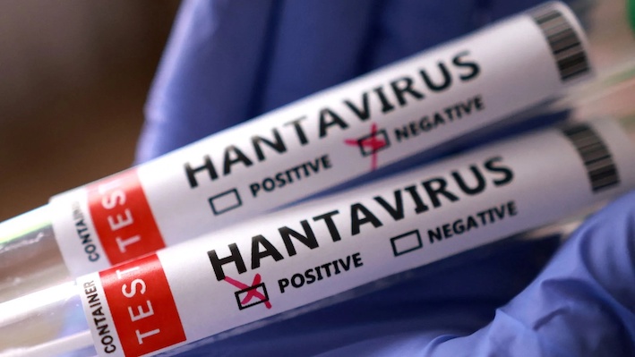 Crece la preocupación por el hantavirus y expertos advierten cuánto podría tardar una vacuna